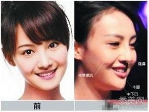 郑州整形失败爆料事件视频,揭秘美容行业潜规则与风险 第3张 郑州整形失败爆料事件视频,揭秘美容行业潜规则与风险 第3张